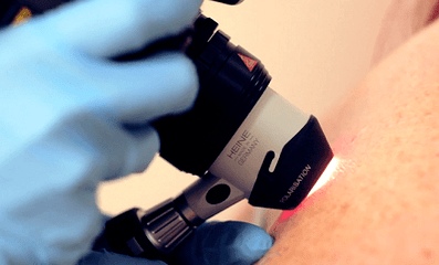 Metodi diagnostici per la verruca plantare