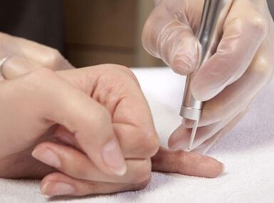 Conduzione della terapia laser